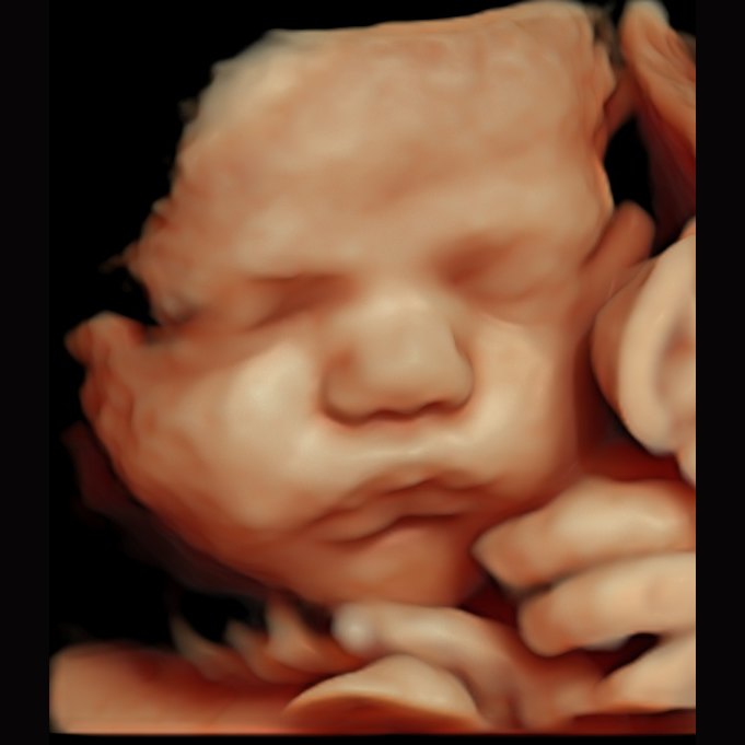 3D HD ultrasound of a baby's face — Wonder Time, Pitman NJ