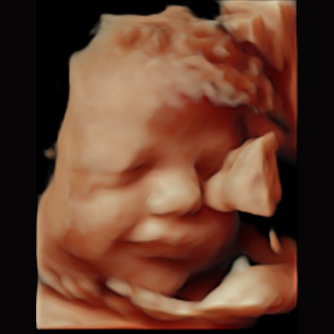 3D ultrasound image of a baby smiling — Wonder Time Pitman