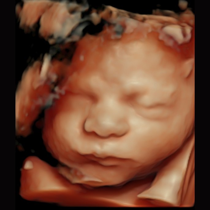 4D ultrasound portrait of a baby — Wonder Time South Jersey