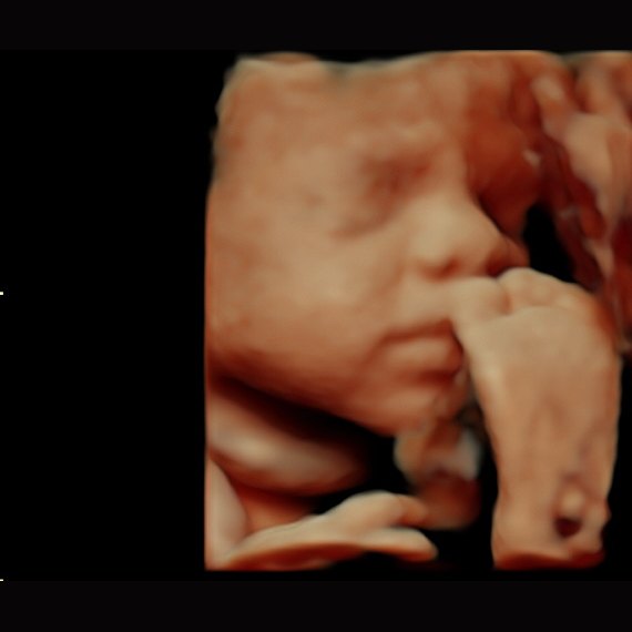 4D ultrasound of a baby with hand near face — Wonder Time