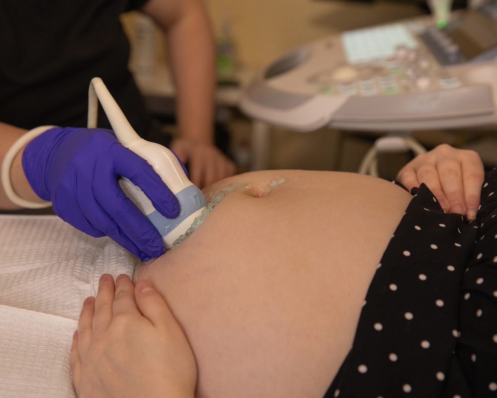 Close-up of an ultrasound scan on a pregnant belly at Wonder Time